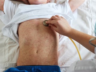 Il Morbillo